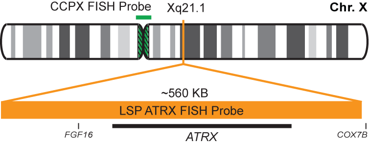 ATRX/CCPX FISH Probe Kit