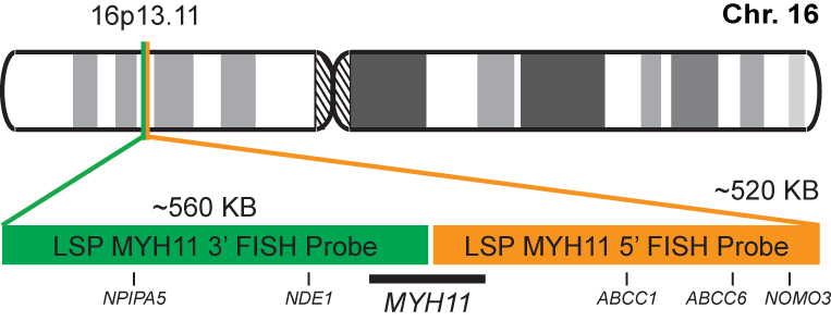 MYH11 Break Apart FISH Probe Kit 