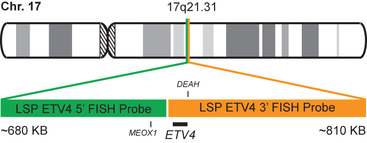 ETV4 Break Apart FISH Probe Kit 