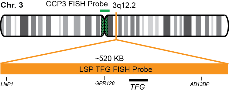 TFG/CCP3 FISH Probe Kit  