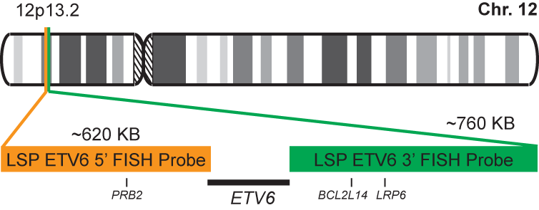 ETV6 Break Apart FISH Probe Kit