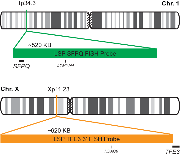 SFPQ-TFE3 Fusion/Translocation FISH Probe Kit 