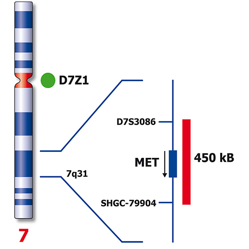 MET (7q31) / SE 7