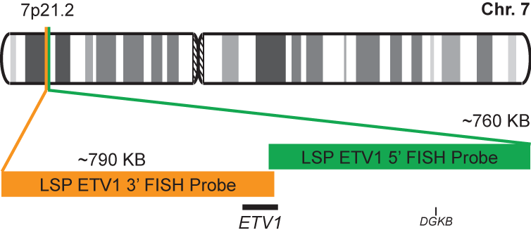 ETV1 Break Apart FISH Probe Kit 