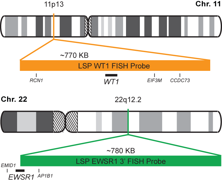 WT1-EWSR1 Fusion/Translocation FISH Probe Kit 