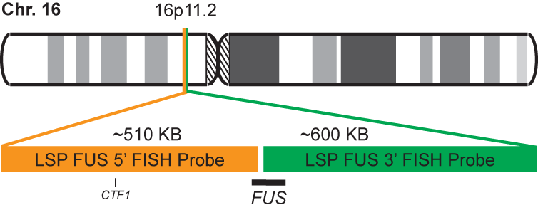 FUS-DDIT3 Fusion/Translocation FISH Probe Kit 
