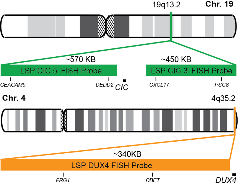 CIC-DUX4 Dual Fusion/Translocation FISH Probe Kit   